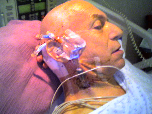 After Brain Surgery